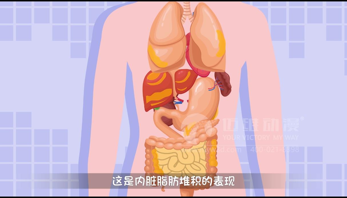 MG動(dòng)畫(huà)，邁維動(dòng)漫.jpg